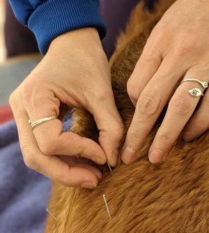 Acupuncture needles